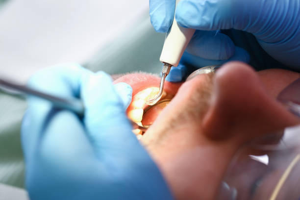 Best 24-Hour Dental Clinic Near Me  in Mclendon Chisholm, TX