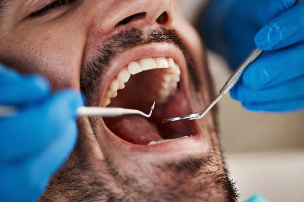 Best Tooth Pain Emergency Relief  in Mclendon Chisholm, TX